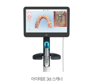 아이테로 3d 스캐너