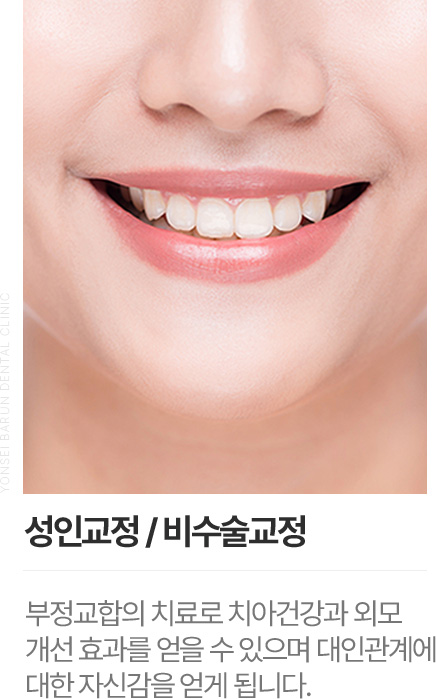 성인교정/비수술교정