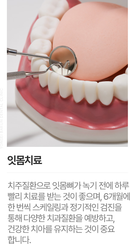 잇몸치료