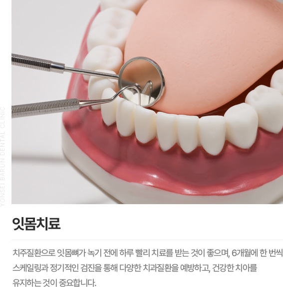 잇몸치료